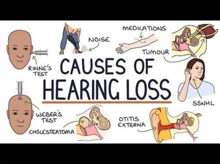 What disease is associated with conductive hearing loss?