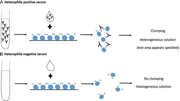 What does a positive heterophile antibody test mean?