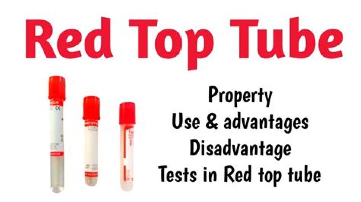 What does a red top tube test for?