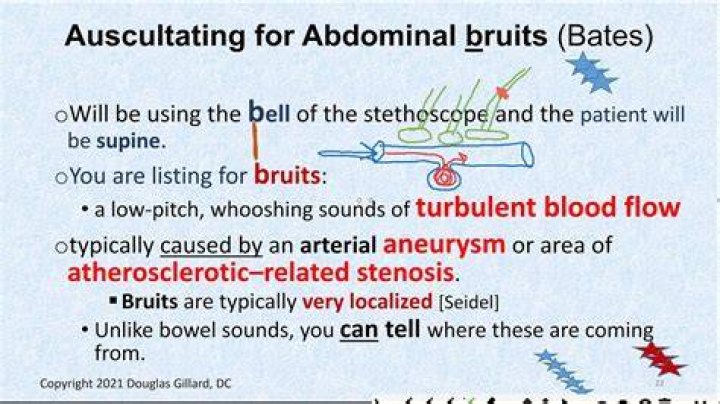 What does an abdominal bruit sound like?