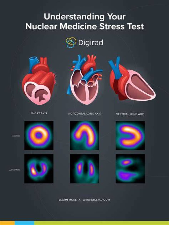 What does an abnormal stress test mean?