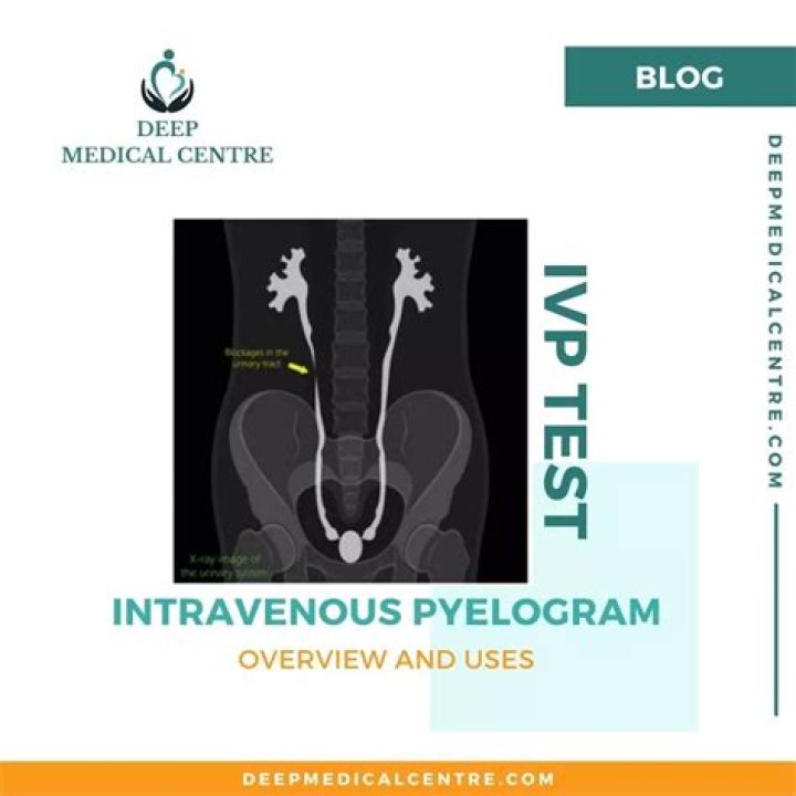 What does an IVP test show?