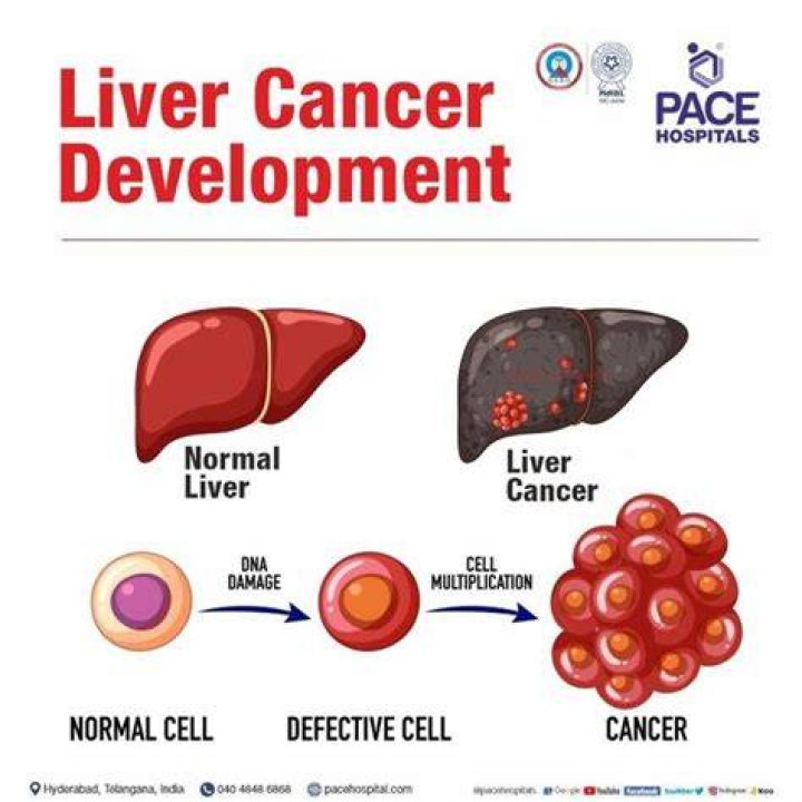 What does cancer in the liver mean?