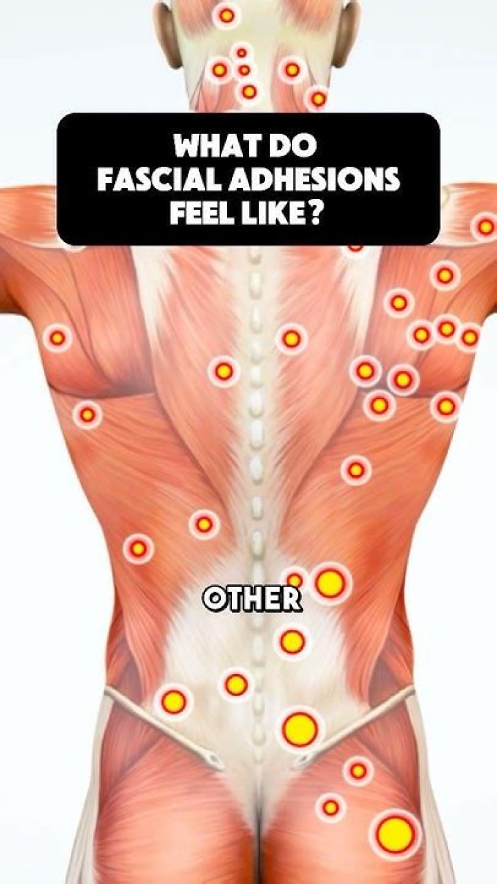 What does fascia feel like?