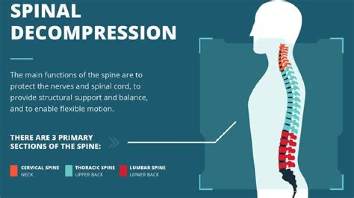 What does it mean to decompress your spine?