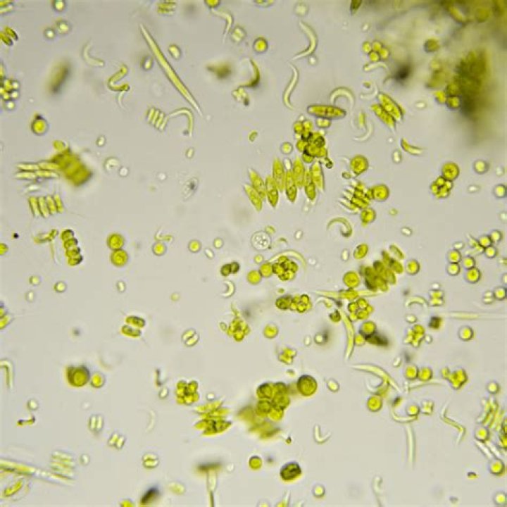 What does phytoplankton look like?