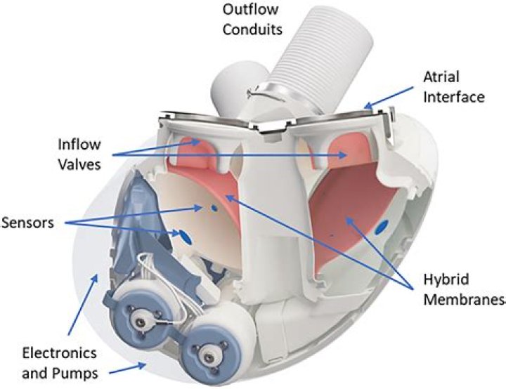 What is a artificial heart made out of?