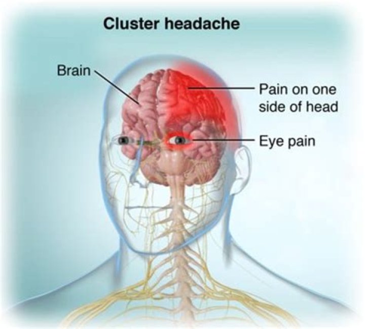 What is a cluster head?