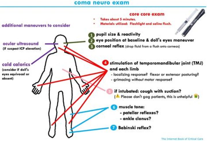 What is a full neurological exam?