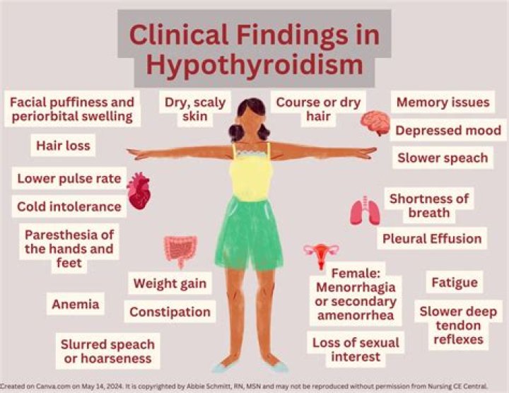 What is acquired hypothyroidism in adults?