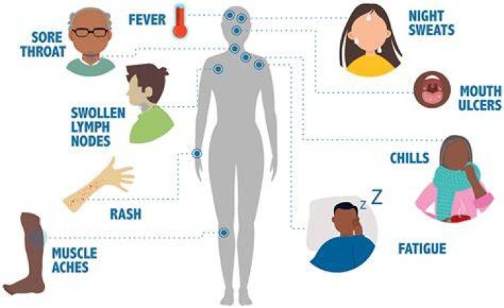 What is AIDS Shortnote? | ContextResponse.com