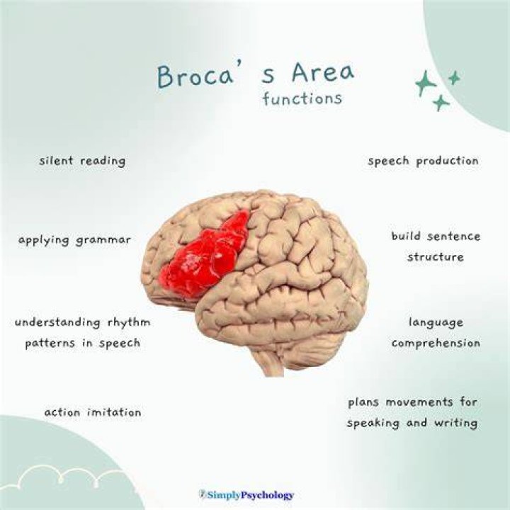 What is Brocas aphasia? | ContextResponse.com