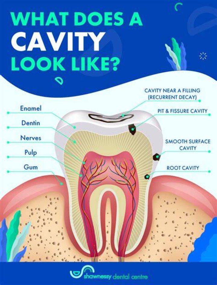 What is cavity science? | ContextResponse.com