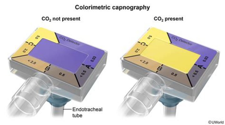 What is colorimetric capnography? | ContextResponse.com