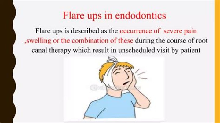 What is endodontic flare up?