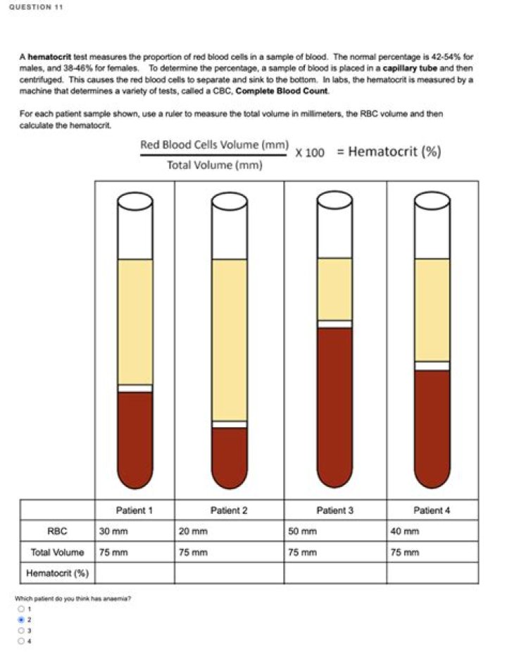 What is hematocrit used for?