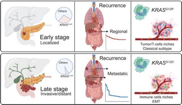 What is KRAS cancer?
