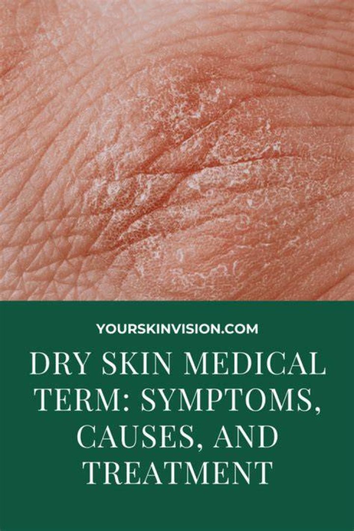 What is medical term for dry skin?