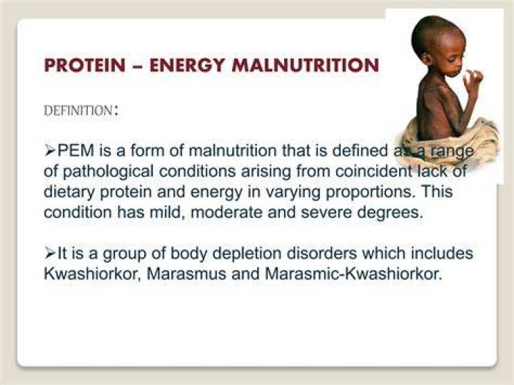 What is protein energy malnutrition PEM?