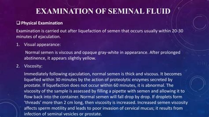 What is seminal discharge? | ContextResponse.com