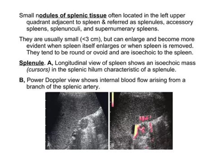 What is Splenule? | ContextResponse.com