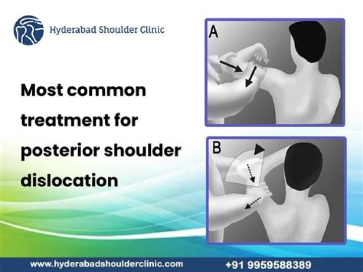 What is the best treatment for shoulder dislocation?