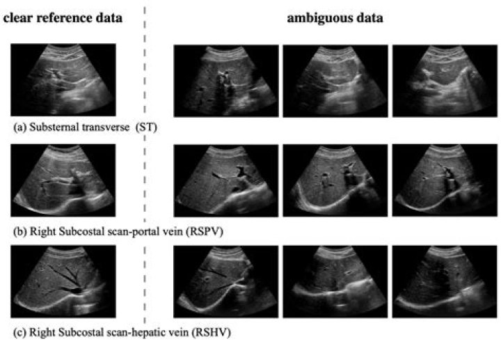 What is the CPT code for liver panel?