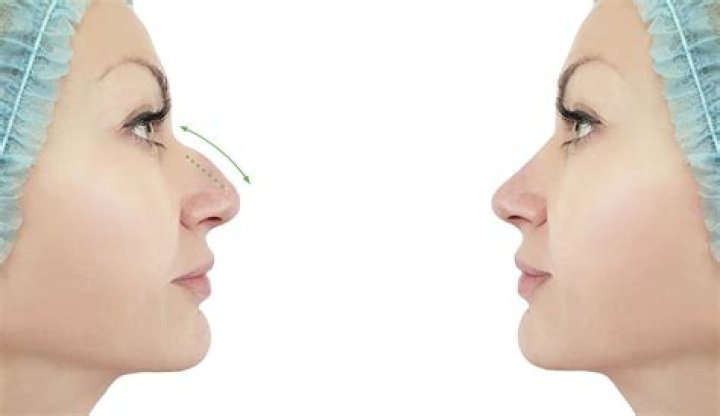 What is the most attractive nose shape?