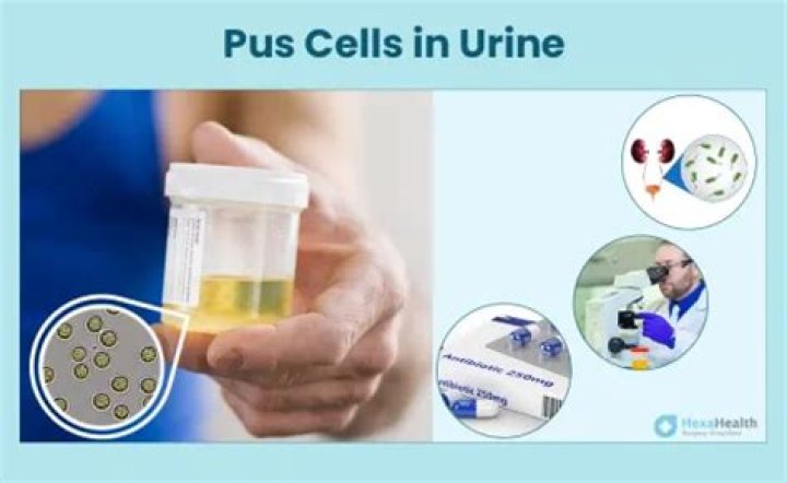 What is the normal range of pus cells in stool?