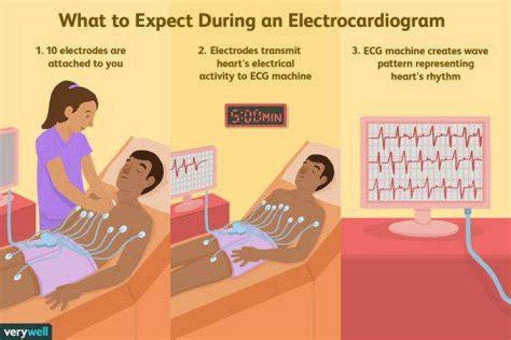 What is the purpose of electrocardiography?