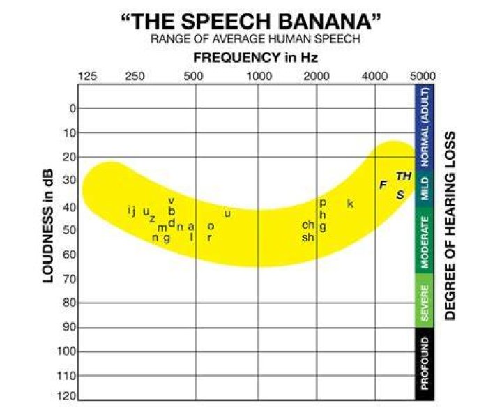 What is the speech banana audiogram?
