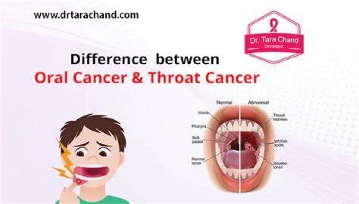 What is uvula cancer?
