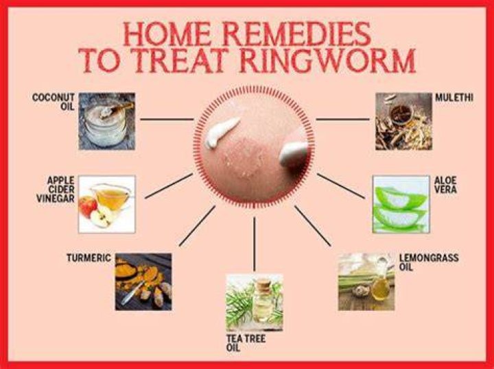 What kills ringworm naturally? | ContextResponse.com