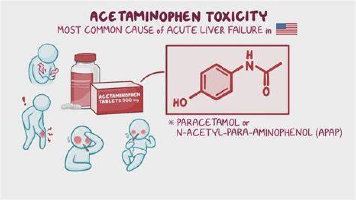 What labs are affected by acetaminophen?