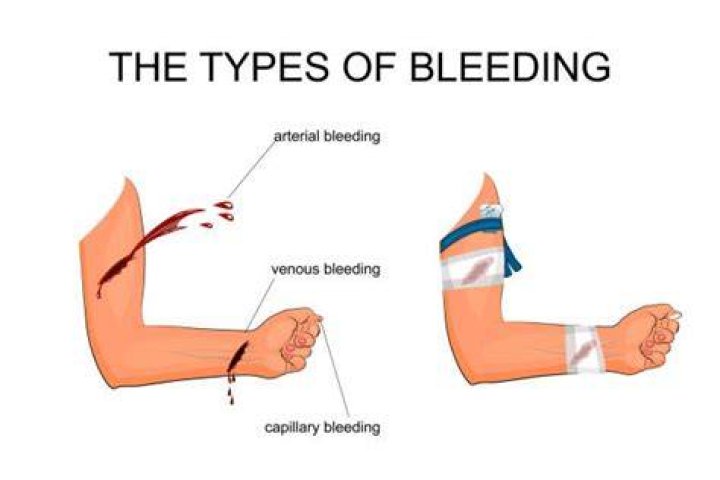 What organ would bleed profusely if injured?