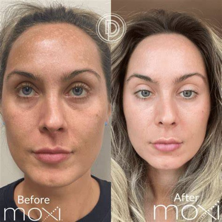 What should I put on my face after electric razor?