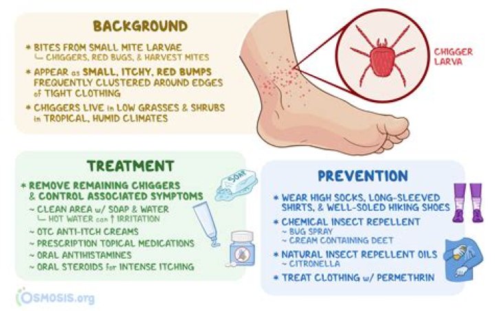What stops chigger bites from itching?