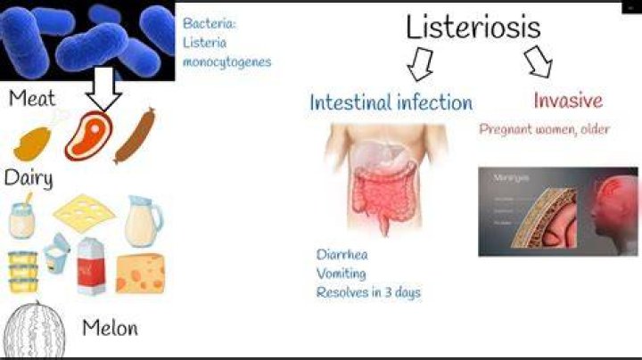 What type of bacteria is Listeria?