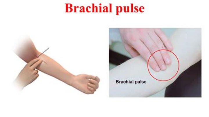 Where is brachial pulse found?