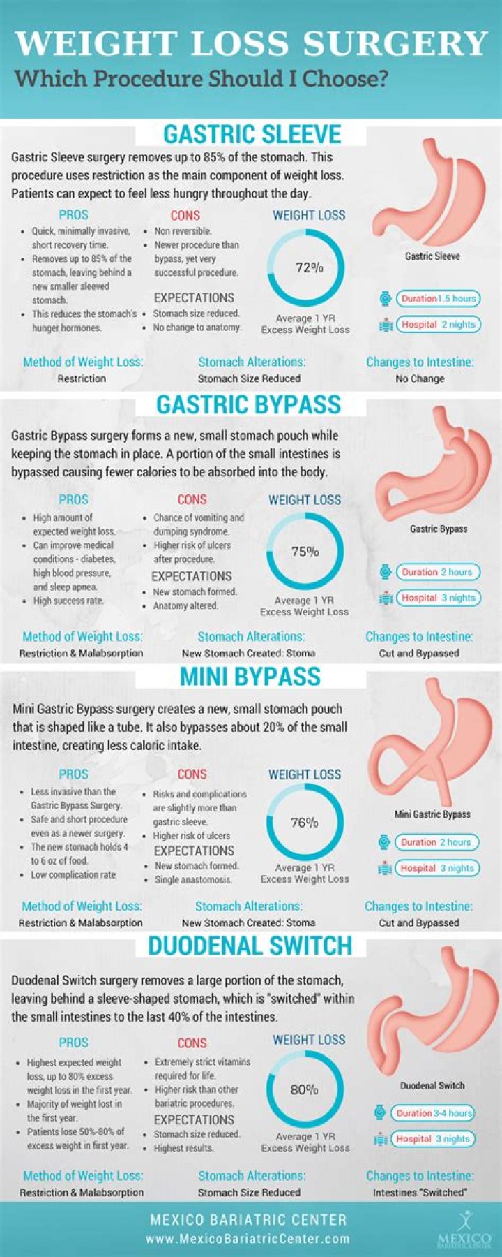 Which is best weight loss surgery?