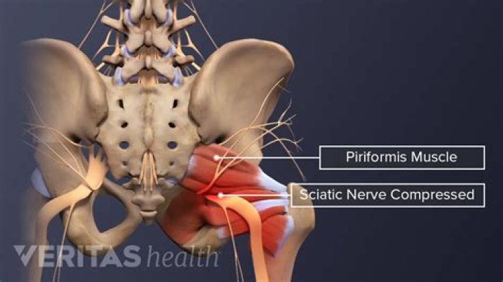 Which nerve is in a position to be compressed by the piriformis muscle?