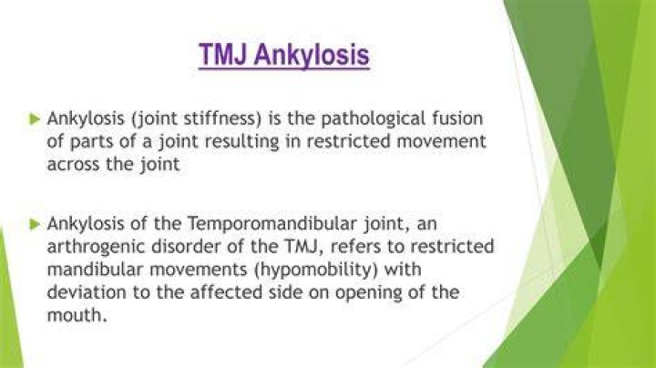 Which teeth are most often affected by ankylosis?