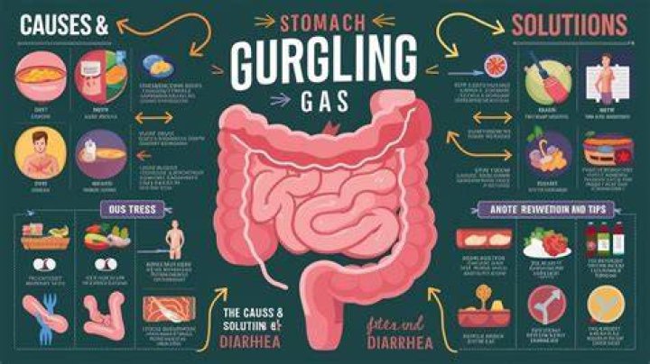 Which term describes the rumbling noise caused by the movement of gas in the intestine?