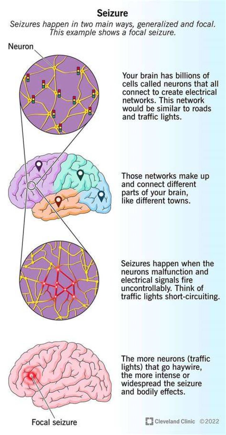 Which type of seizures involves a loss of consciousness?