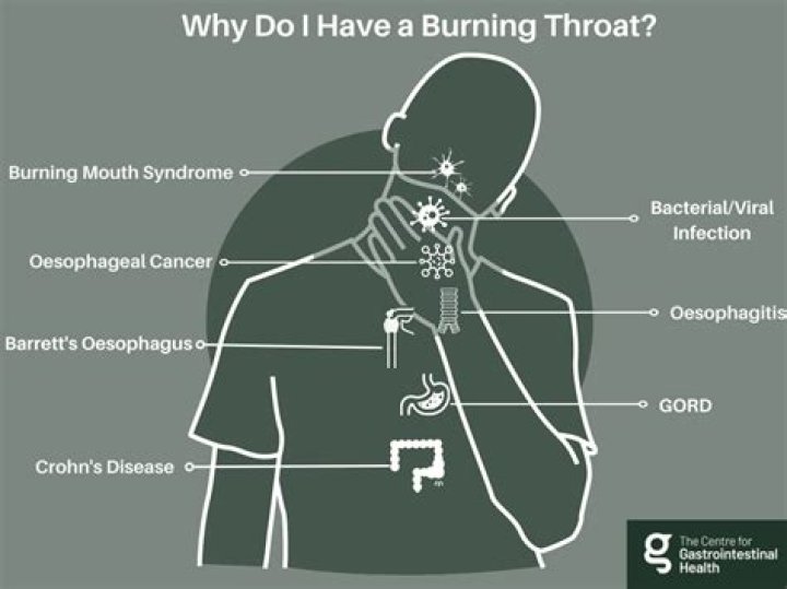 Why can I smell burning?