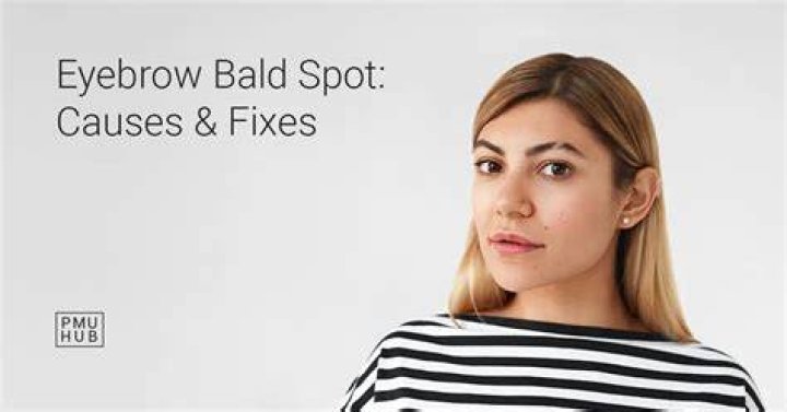 Why do I have a bald spot on my eyebrow?