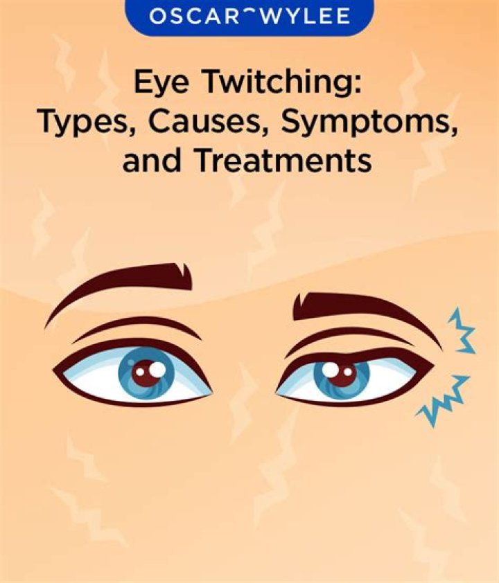 Why do my eyes run all the time?