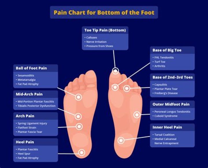 Why do the bottom of my feet hurt?