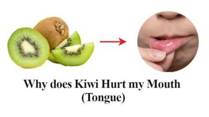 Why does kiwi make my mouth tingle?