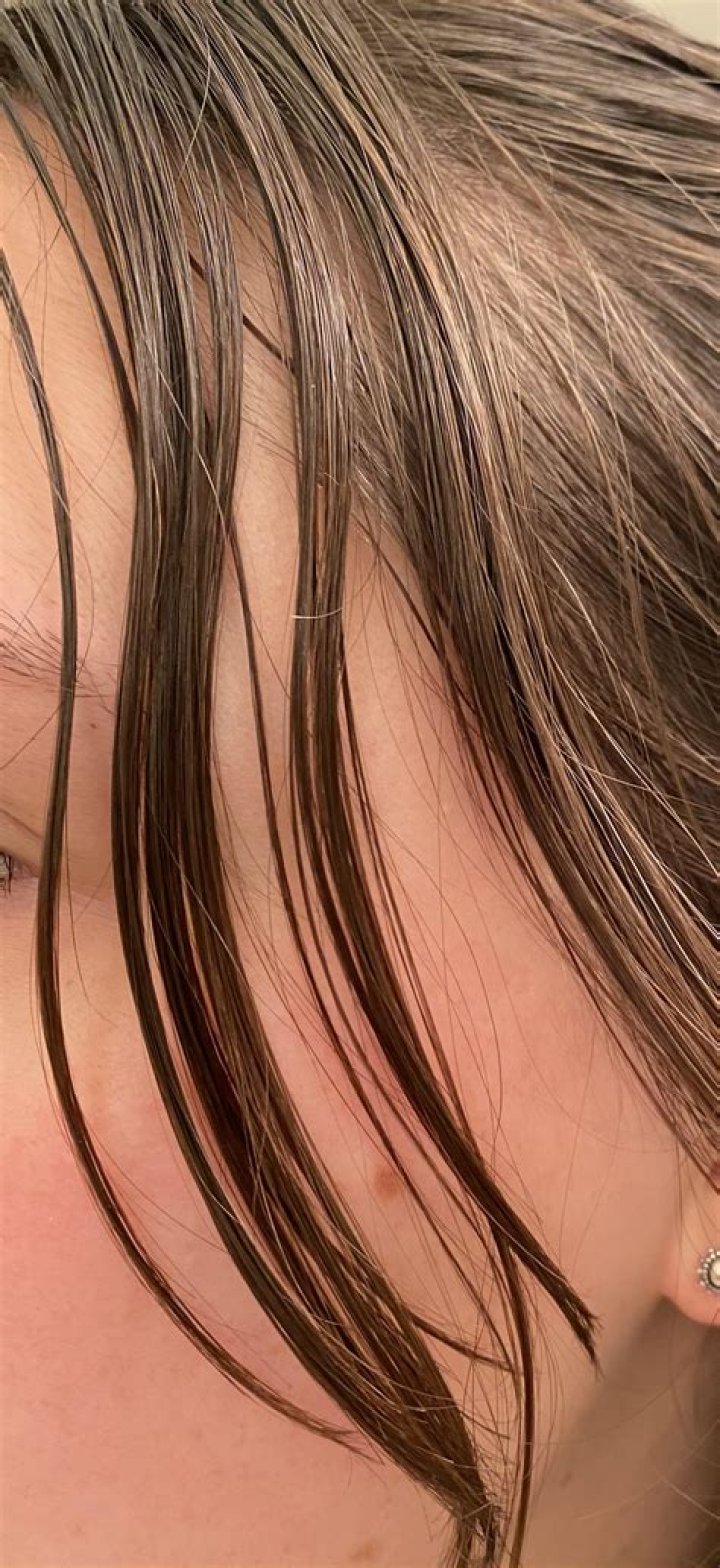 Why does my head hurt when my hair is oily?